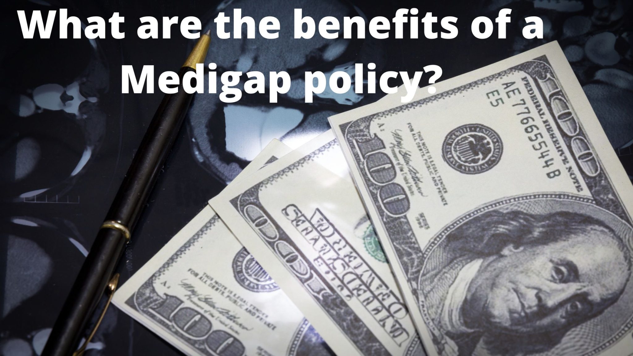 10 Troubling Issues with Medigap Policies and What You Can do to ...